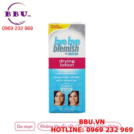 Kem trị mụn bye bye blemish drying lotion